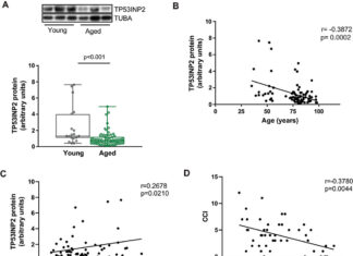 Study shows TP53INP2 protein could provide new way to combat muscle loss during aging Study shows TP53INP2 protein could provide new way to combat muscle loss during aging