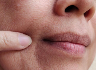 6 Dehydrating Beverages Derms Suggest Cutting Out To Prevent Premature Aging & Wrinkles 6 Dehydrating Beverages Derms Suggest Cutting Out To Prevent Premature Aging & Wrinkles