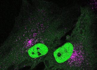 A new pathway involved in aging A new pathway involved in aging