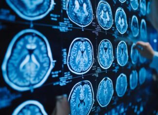 Lower Blood Sugar Diet Linked to Slower Brain Aging Neuroscience News logo for mobile.