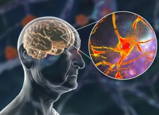 Socioeconomic inequality and pollution linked to accelerated brain aging Socioeconomic inequality and pollution linked to accelerated brain aging