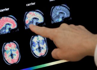 Up to 4 in 10 Older People Could Develop Dementia Up to 4 in 10 Older People Could Develop Dementia