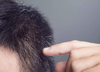 Anti-aging secret? This antioxidant can stop hair graying, discover scientists Anti-aging secret? This antioxidant can stop hair graying, discover scientists