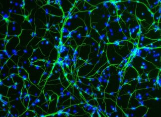 Aging Women’s Brain Mysteries Are Tested in Trio of Studies Aging Women’s Brain Mysteries Are Tested in Trio of Studies