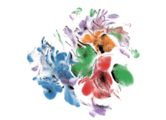 New software finds aging cells that contribute to disease and health risks A graphic of multi-colored clusters with some containing black dots representing cells.