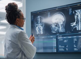 Brains of people with schizophrenia may age faster – how our research adds to the evidence Brains of people with schizophrenia may age faster – how our research adds to the evidence