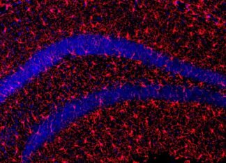 Novel Therapeutic Strategy for Healthy Aging and Longevity Microscopic image of microglial cells (part of the brain