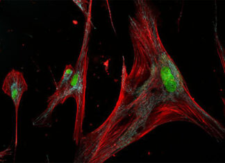 Scientists find subtypes of senescence Scientists find subtypes of senescence