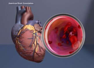 Study finds heart health declining in older adults with certain cardiovascular diseases Study finds heart health declining in older adults with certain cardiovascular diseases
