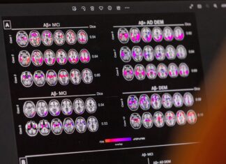 These four healthy habits can boost cognitive function in older age, study finds These four healthy habits can boost cognitive function in older age, study finds