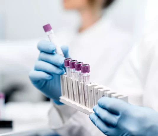 Frontiers | Community environmental assessment for migrant seniors’ mental health: a multi-attribute decision-making model Frontiers | Community environmental assessment for migrant seniors’ mental health: a multi-attribute decision-making model