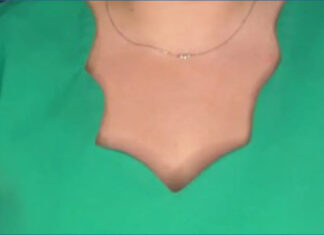 MercyOne Aledo, Dewitt announce program for senior mental health MercyOne Aledo, Dewitt announce program for senior mental health