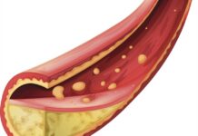 Statins may help prevent frailty in older adults Statins may help prevent frailty in older adults